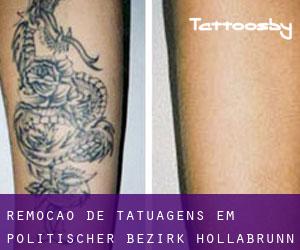 Remoção de tatuagens em Politischer Bezirk Hollabrunn