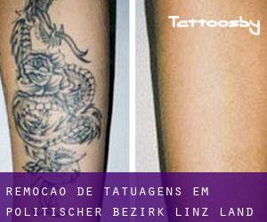 Remoção de tatuagens em Politischer Bezirk Linz Land