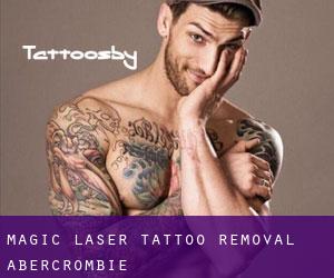 Magic Laser Tattoo Removal (Abercrombie)